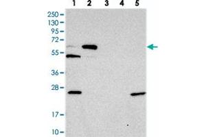 Western blot analysis of Lane 1: RT-4, Lane 2: U-251 MG, Lane 3: Human Plasma, Lane 4: Liver, Lane 5: Tonsil with C10orf33 polyclonal antibody . (PYROXD2 Antikörper)