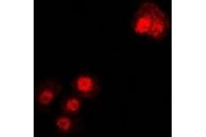 Immunofluorescent analysis of Alpha-tubulin 4a staining in U2OS cells. (TUBA4A Antikörper)