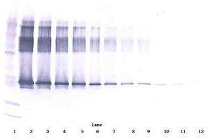 Image no. 1 for anti-serpin Peptidase Inhibitor, Clade A (Alpha-1 Antiproteinase, Antitrypsin), Member 12 (SERPINA12) antibody (ABIN465901) (SERPINA12 Antikörper)