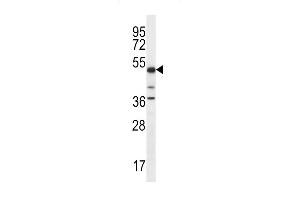 Western blot analysis in K562 cell line lysates (35ug/lane). (PSTPIP1 Antikörper  (N-Term))