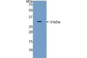 Detection of Recombinant GHR, Mouse using Polyclonal Antibody to Growth Hormone Receptor (GHR) (Growth Hormone Receptor Antikörper  (AA 36-266))
