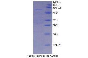 SDS-PAGE (SDS) image for Mesothelin (MSLN) (AA 345-548) protein (His tag,GST tag) (ABIN2123263)