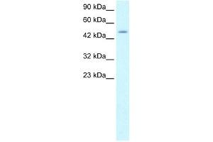 WB Suggested Anti-ZNF365 Antibody Titration: 1. (ZNF365 Antikörper  (N-Term))