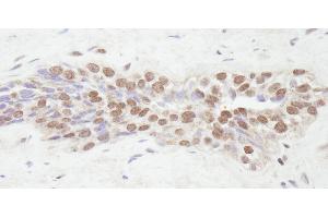 Immunohistochemistry (IHC) image for anti-Nuclear Receptor Coactivator 2 (NCOA2) (C-Term) antibody (ABIN7448683)