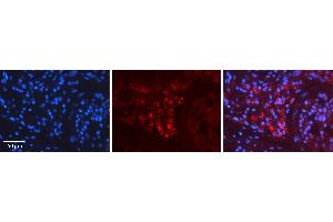 Rabbit Anti-RET Antibody Catalog Number: ARP30878_P050 Formalin Fixed Paraffin Embedded Tissue: Human Testis Tissue Observed Staining: Cytoplasm Primary Antibody Concentration: 1:600 Other Working Concentrations: N/A Secondary Antibody: Donkey anti-Rabbit-Cy3 Secondary Antibody Concentration: 1:200 Magnification: 20X Exposure Time: 0. (Ret Proto-Oncogene Antikörper  (C-Term))