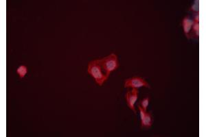 ABIN6274009 staining HeLa cells by ICC/IF. (ENO1 Antikörper  (C-Term))