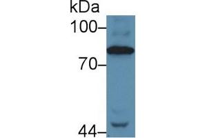 Western Blot; Sample: Human Serum; Primary Ab: 5µg/ml Rabbit Anti-Human C4 Antibody Second Ab: 0. (Complement C4 Antikörper  (AA 975-1336))