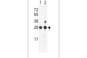 Western blot analysis of PSMB1 Antibody (C-term) (ABIN652802 and ABIN2842525) in mouse NIH-3T3 cell line(lane 1) and mouse bladder tissue(lane 2) lysates (35 μg/lane). (PSMB1 Antikörper  (C-Term))