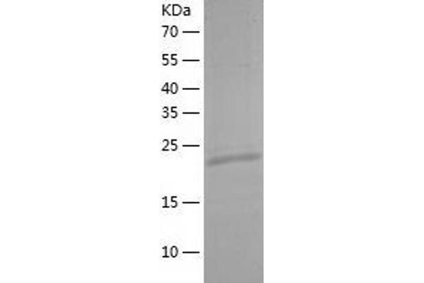 TRAPPC4 Protein (AA 1-219) (His tag)