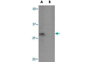 Western blot analysis of ACOT13 in HepG2 cell lysate with ACOT13 polyclonal antibody  at 1 ug/mL in (A) the absence and (B) the presence of blocking peptide. (THEM2 Antikörper  (C-Term))
