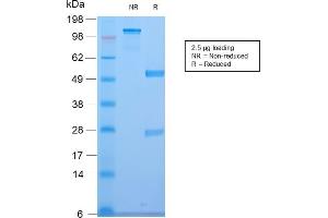 SDS-PAGE Analysis of Purified CELA3B Rabbit Recombinant Monoclonal Antibody (CELA3B/2810R). (Rekombinanter Elastase 3B Antikörper  (AA 82-238))