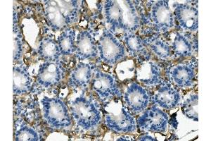 IHC analysis of MCAM using anti-MCAM antibody (ABIN7601026).