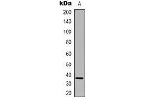 Western blot analysis of FAM84B expression in HUVEC (A) whole cell lysates. (FAM84B Antikörper  (N-Term))