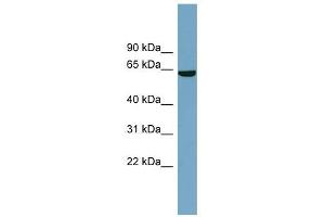 SLC5A8 antibody used at 1 ug/ml to detect target protein. (SLC5A8 Antikörper)