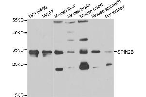 Western blot analysis of extracts of various cell lines, using SPIN2B antibody (ABIN4905283) at 1:1000 dilution. (Spindlin 2B Antikörper)
