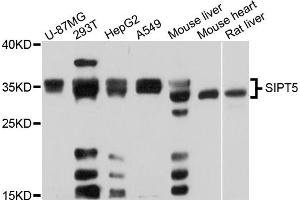 Western blot analysis of extracts of various cell lines, using SIRT5 antibody (ABIN5973406) at 1/1000 dilution. (SIRT5 Antikörper)