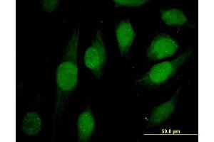 Immunofluorescence of monoclonal antibody to ATRX on HeLa cell. (ATRX Antikörper  (AA 2311-2410))