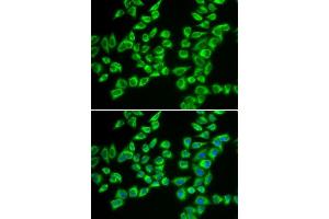 Immunofluorescence analysis of A549 cells using HADHB antibody. (HADHB Antikörper  (AA 34-270))