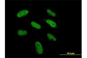 Immunofluorescence of purified MaxPab antibody to DGCR6 on HepG2 cell. (DGCR6 Antikörper  (AA 1-220))
