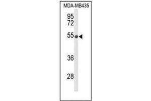 Western blot analysis of DMC1 Antibody (N-term) in MDA-MB435 cell line lysates (35ug/lane).
