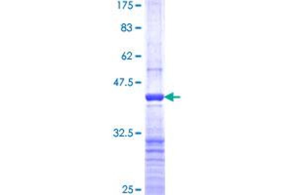 DAZ1 Protein (AA 21-120) (GST tag)