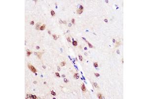 Immunohistochemistry of paraffin-embedded Rat brain using CELF1 Rabbit pAb (ABIN6131012, ABIN6138399, ABIN6138400 and ABIN6221641) at dilution of 1:100 (40x lens). (CELF1 Antikörper  (AA 108-483))