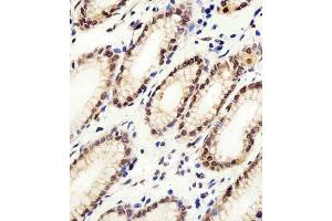 Immunohistochemical analysis of paraffin-embedded H. (CSE1L Antikörper  (N-Term))