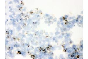IHC testing of frozen rat lung with SFTPA1/2 antibody. (SFTPA1/ 2 Antikörper)