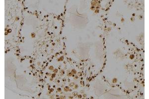 ABIN6277485 at 1/100 staining Human lung tissue by IHC-P.