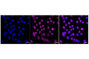 Immunocytochemical staining of HepG2 cells with Lysine demethylase 1B antibody (ABIN7799298), 1:1,000). (Rekombinanter KDM1B Antikörper)
