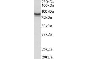 Staining of Mouse Brain lysate usng DLG4 / PSD95 antibody at 0.