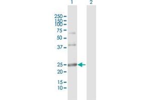 Western Blot analysis of ARL4D expression in transfected 293T cell line by ARL4D MaxPab polyclonal antibody.
