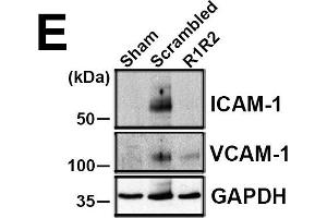 R1R2 decreases inflammatory cell accumulation and VCAM-1 and ICAM-1 levels. (ICAM1 Antikörper)