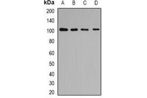 Western blot analysis of p102 expression in Hela (A), HepG2 (B), mouse liver (C), mouse kidney (D) whole cell lysates.