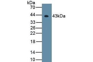 Detection of Recombinant HDAC11, Mouse using Polyclonal Antibody to Histone Deacetylase 11 (HDAC11) (HDAC11 Antikörper  (AA 1-347))