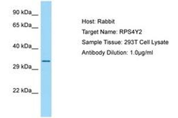 RPS4Y2 抗体  (AA 166-215)