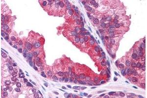 Human Prostate: Formalin-Fixed, Paraffin-Embedded (FFPE) (PLEKHM3 Antikörper  (C-Term))