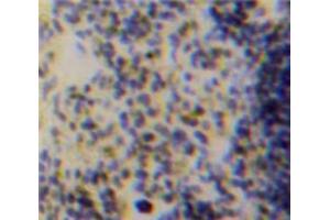 Used in DAB staining on fromalin fixed paraffin-embedded Spleen tissue (ACP5 Antikörper  (AA 28-286))