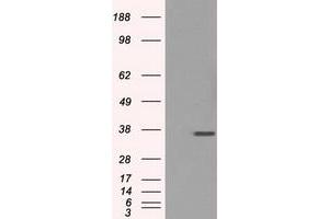 Image no. 2 for anti-Fc Fragment of IgG, Low Affinity IIa, Receptor (CD32) (FCGR2A) antibody (ABIN1497263)