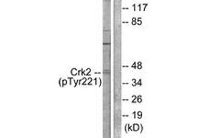 Western blot analysis of extracts from COS7 cells, using CrkII (Phospho-Tyr221) Antibody. (Crk Antikörper  (pTyr221))
