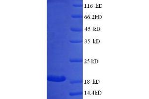 SDS-PAGE (SDS) image for Beta Lactoglobulin (LGB) (full length) protein (ABIN7479571) (Beta Lactoglobulin (LGB) (full length) Protein)