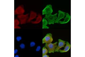 staining Hela cells(30 min of UV treatment) by IF/ICC. (GPR171 Antikörper  (Internal Region))