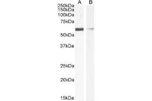 ABIN6391377 (1µg/ml) staining of HEK293 (A) and HeLa (B) cell lysate (35µg protein in RIPA buffer). (IDE Antikörper  (AA 10-14))