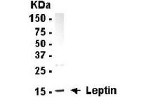 Western Blotting (WB) image for anti-Leptin (LEP) (full length) antibody (ABIN2467855) (Leptin Antikörper  (full length))