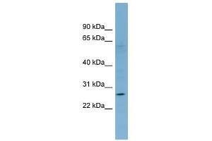 KLRF1 antibody used at 1 ug/ml to detect target protein.