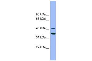 WB Suggested Anti-GATA5 Antibody Titration:  0. (GATA5 Antikörper  (Middle Region))