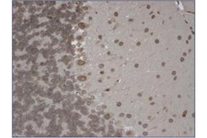 Immunohistochemistry (IHC) image for anti-Transient Receptor Potential Cation Channel, Subfamily M, Member 7 (TRPM7) (AA 1817-1863), (C-Term) antibody (ABIN452417) (TRPM7 Antikörper  (C-Term))