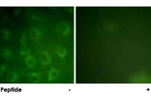 Immunofluorescence analysis of COS-7 cells, using PDGFRB polyclonal antibody . (PDGFRB Antikörper)
