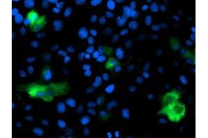 Anti-DPP9 mouse monoclonal antibody (ABIN2455318) immunofluorescent staining of COS7 cells transiently transfected by pCMV6-ENTRY DPP9 (RC224465). (DPP9 Antikörper)