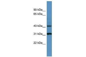 Western Blot showing Ctsd antibody used at a concentration of 1-2 ug/ml to detect its target protein. (Cathepsin D Antikörper  (C-Term))